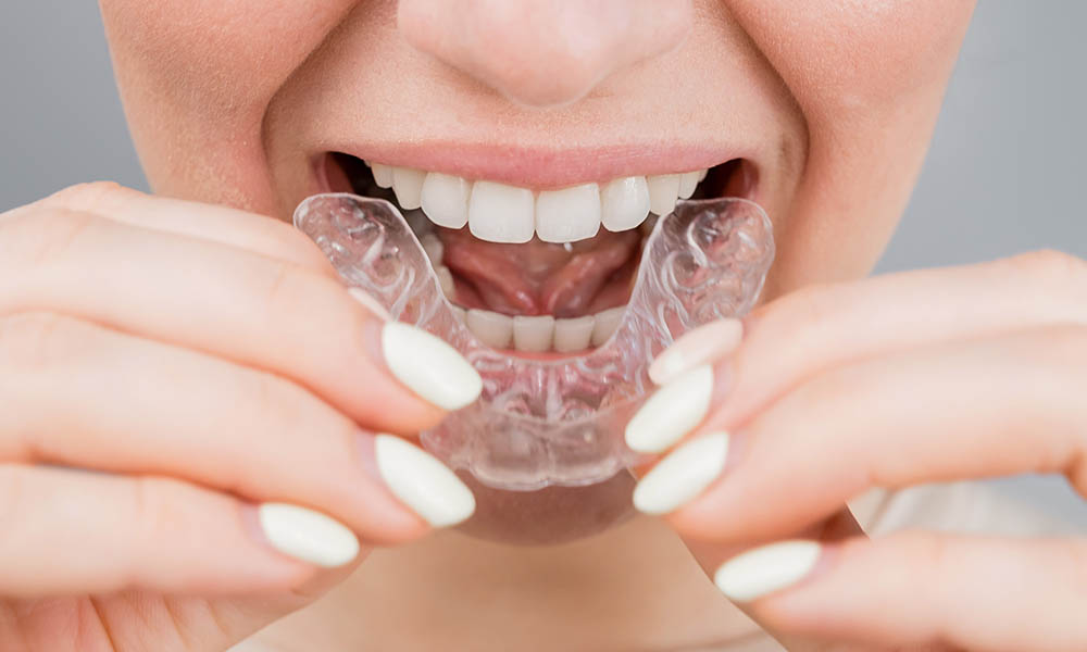 Wearing and Caring for Your New Retainers